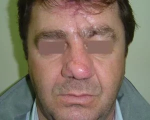&epsilon;&pi;&alpha;&nu;&omicron;&rho;&theta;&omega;&tau;&iota;&kappa;ή &chi;&epsilon;&iota;&rho;&omicron;&upsilon;&rho;&gamma;&iota;&kappa;ή 5&Mu;-734-300-240-80-c