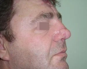 &epsilon;&pi;&alpha;&nu;&omicron;&rho;&theta;&omega;&tau;&iota;&kappa;ή &chi;&epsilon;&iota;&rho;&omicron;&upsilon;&rho;&gamma;&iota;&kappa;ή 6&Mu;-736-300-240-80-c