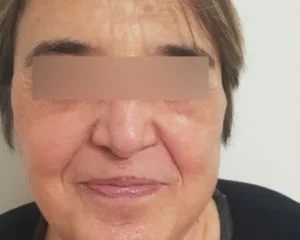 facelift_1__3-1843-300-240-80-c